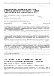 УДЛИНЕНИЕ ЛОКТЕВОЙ КОСТИ МЕТОДОМ ДИСТРАКЦИОННОГО ОСТЕОСИНТЕЗА У ДЕТЕЙ С ВРОЖДЕННОЙ ЛУЧЕВОЙ КОСОРУКОСТЬЮ