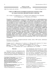 Синтез в СВЧ-плазме поликристаллических алмазных слоёв на тонких пластинах кремния большого диаметра