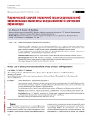 Клинический случай первичной транскорпоральной имплантации манжеты искусственного мочевого сфинктера