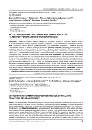 МЕТОД ОПРЕДЕЛЕНИЯ ПОЛОЖЕНИЯ И РАЗМЕРОВ ЧЕЛЮСТЕЙ НА ТЕЛЕРЕНТГЕНОГРАММЕ В БОКОВОЙ ПРОЕКЦИИ