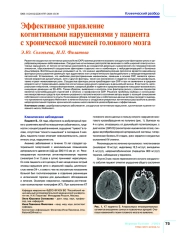 Эффективное управление когнитивными нарушениями у пациента с хронической ишемией головного мозга