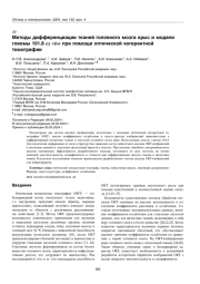 Методы дифференциации тканей головного мозга крыс и модели глиомы 101.8 ex vivo при помощи оптической когерентной томографии