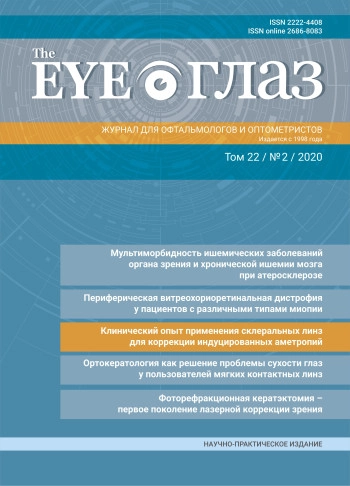 THE EYE ГЛАЗ